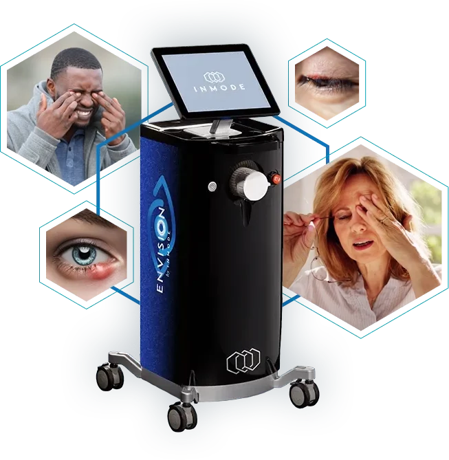 The Envision InMode Machine and photos of patients who may benefit from its treatment