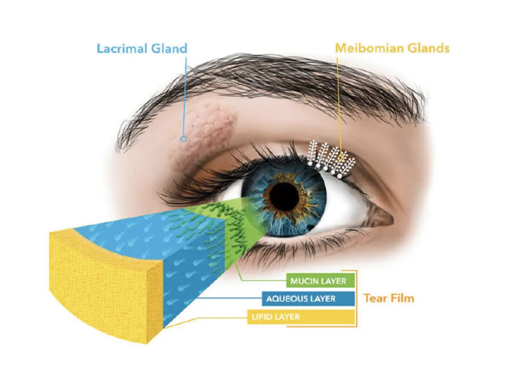 A diagram showing the layers of mucus on the eye